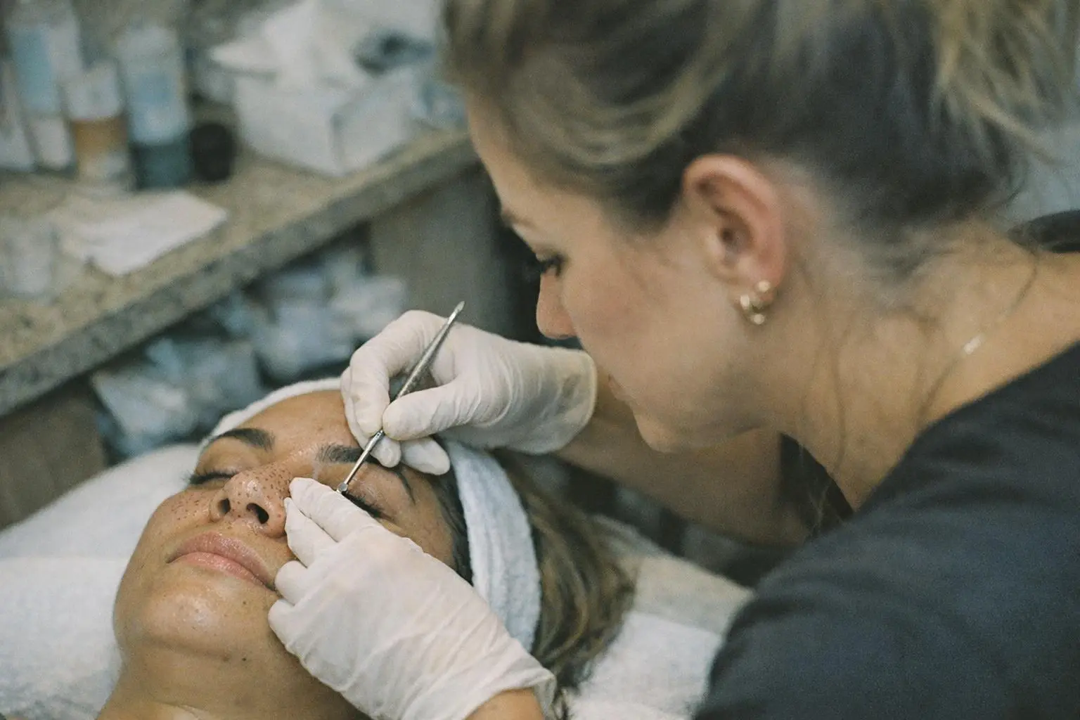 How Comedones applies to Beauty Salon services in West Palm Beach, United States—practical illustration