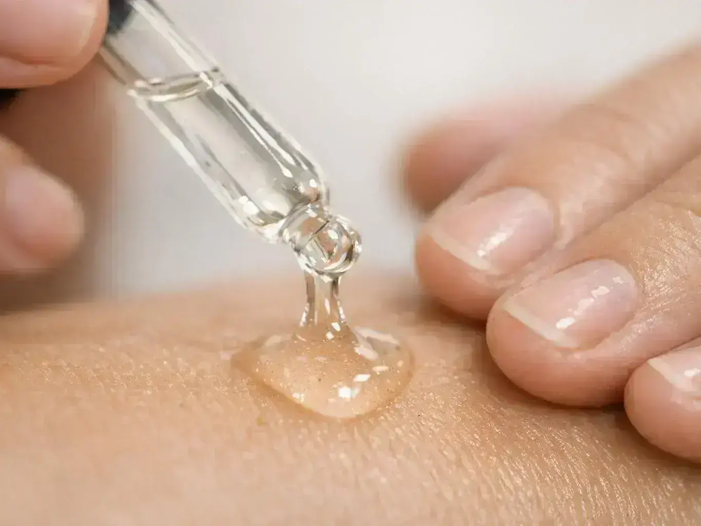 TCA Peel Definition & Examples — in action